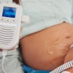 Comment les dopplers foetaux révolutionnent le suivi de grossesse ?