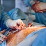 Complications possibles de la petite chirurgie : prévention et gestion