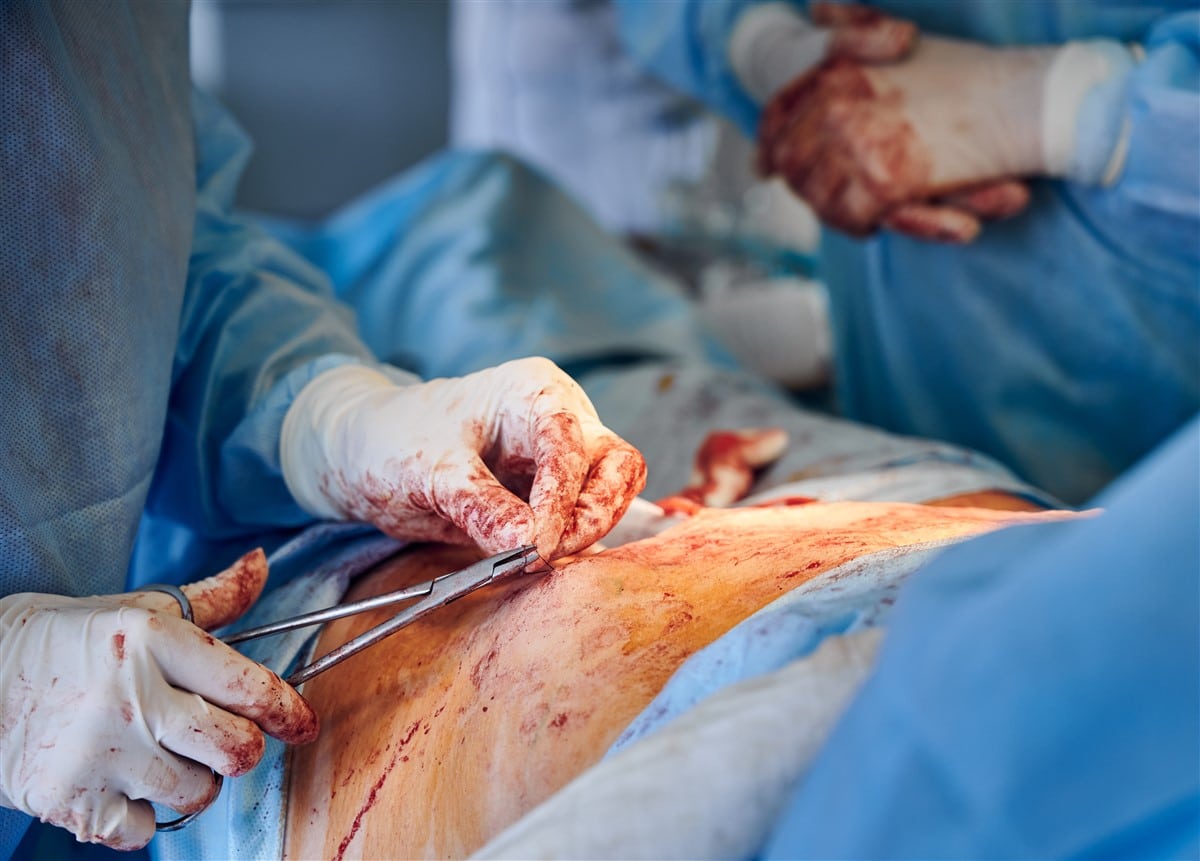 petite chirurgie